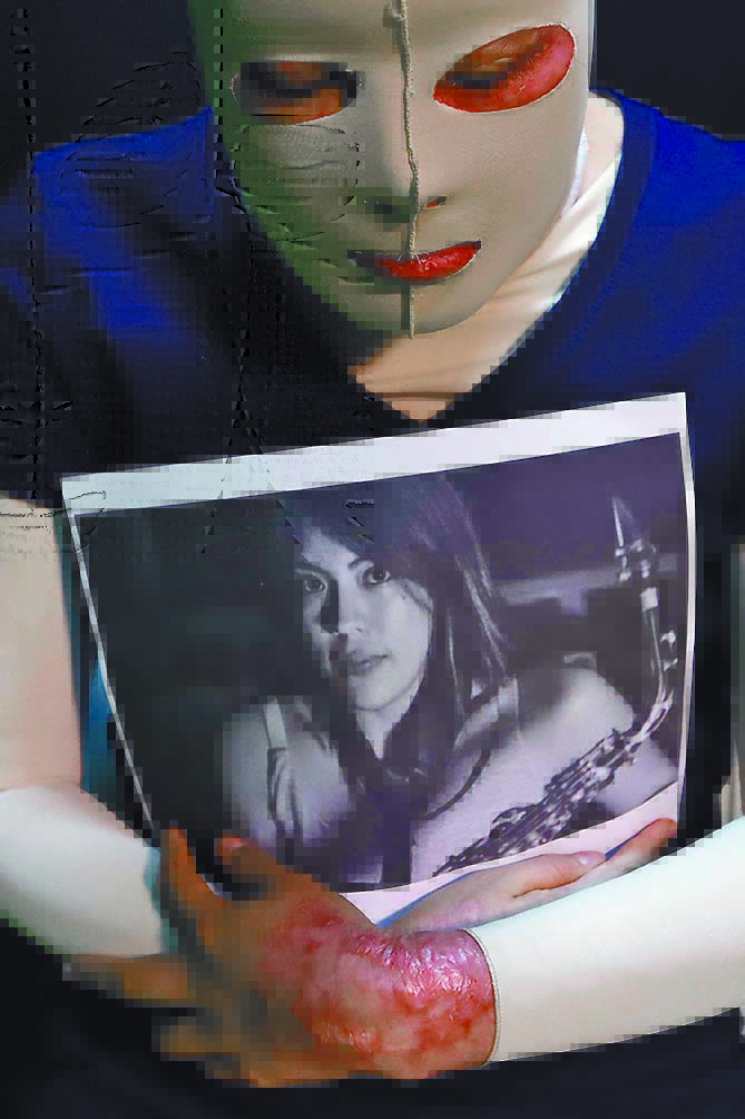 Llama víctima quemada con ácido en Oaxaca a alzar la voz