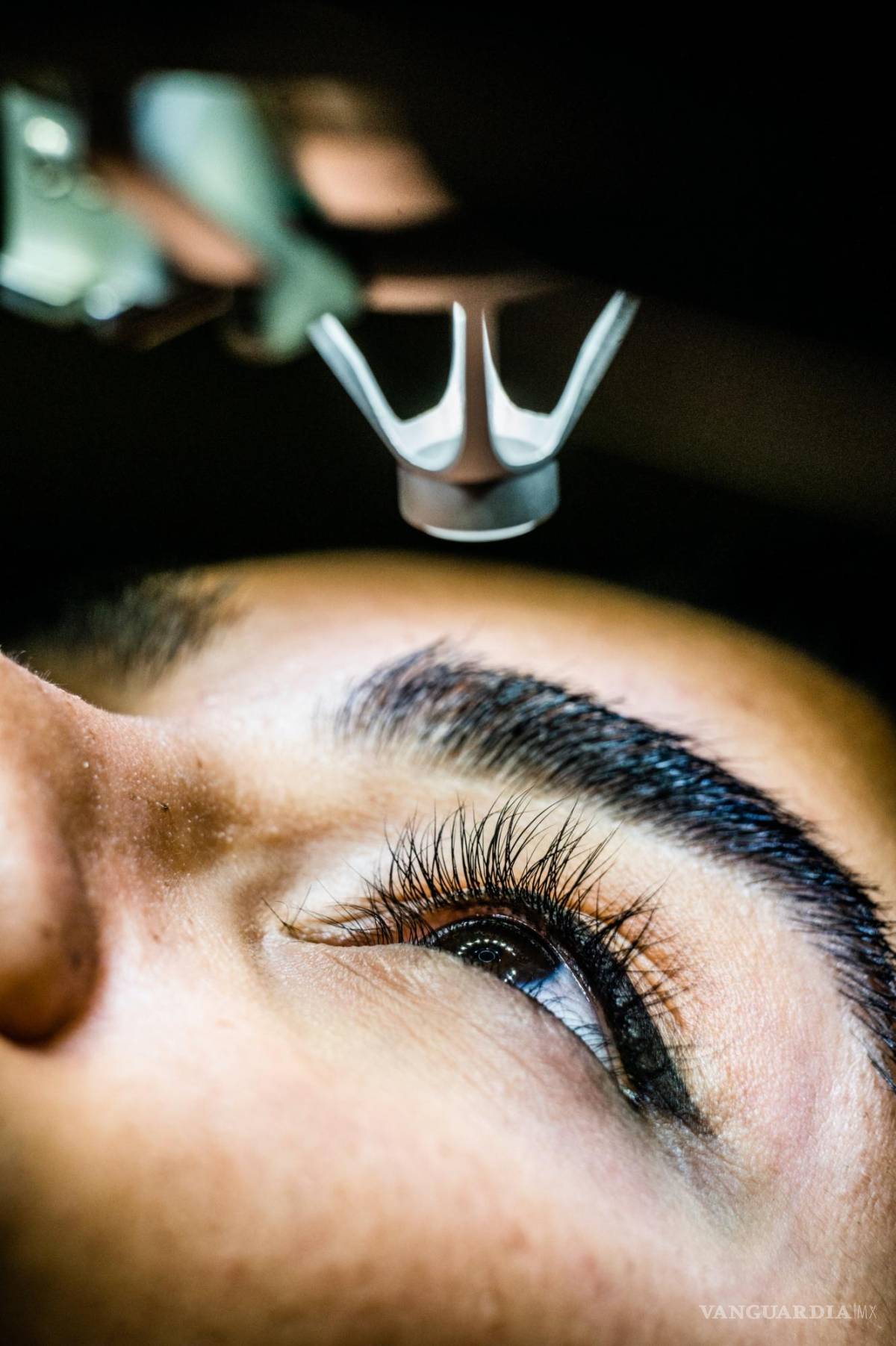 $!Un implante de bioingeniería podría ser una alternativa al trasplante de córneas humanas donadas.