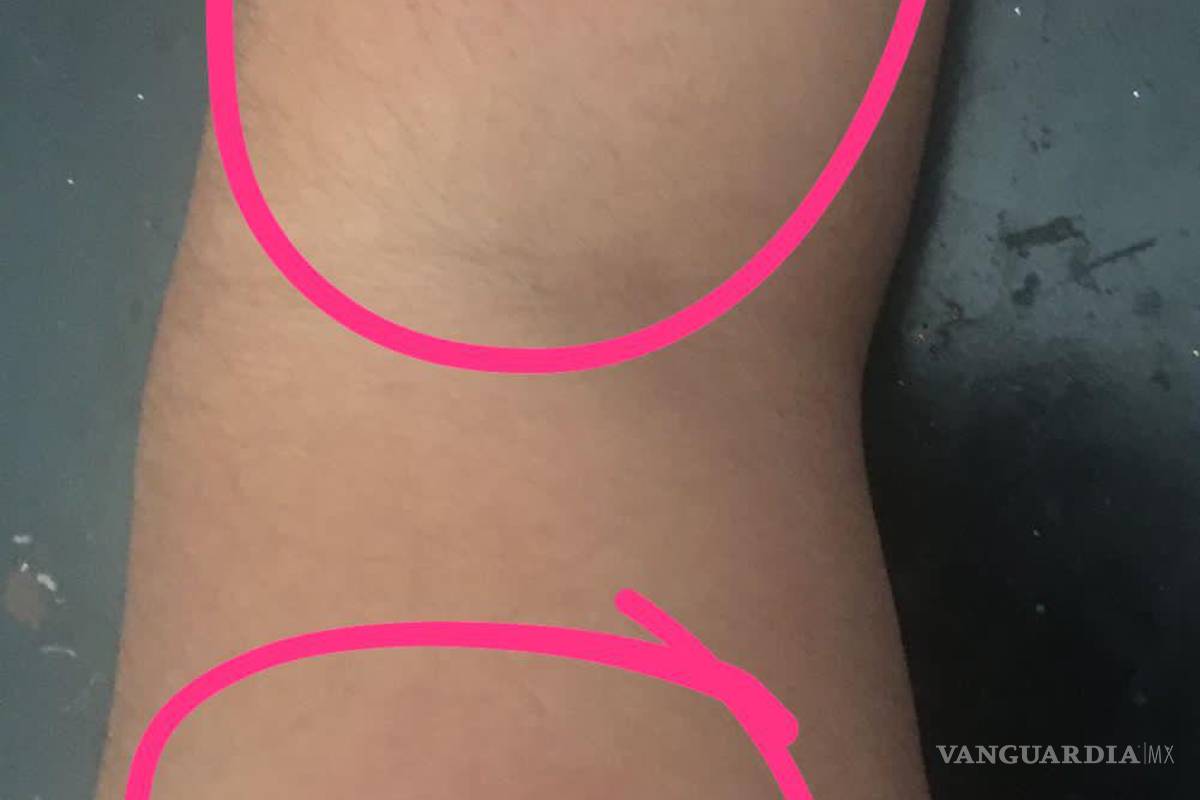 Paramédico de la Cruz Roja de Saltillo viola orden de restricción y agrede a ex pareja