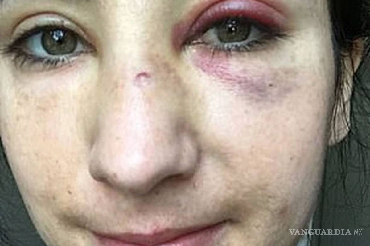 $!Golpean brutalmente a azafata y su novia en autobús de Londres, querían obligarlas a besarse