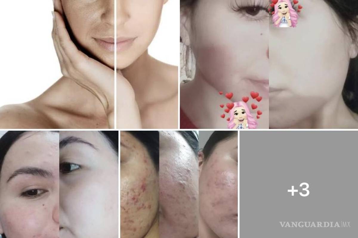 Alertan por venta de maquillaje de mala calidad en el Centro de Saltillo; provoca severas alergias