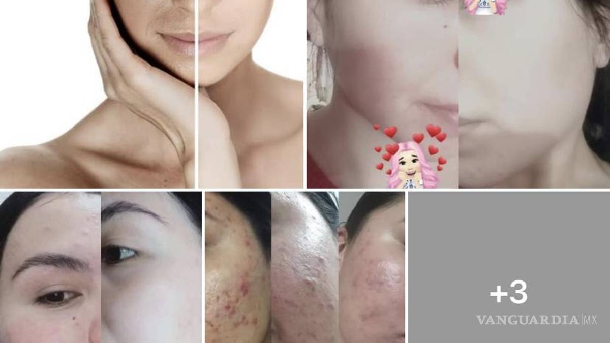 Alertan por venta de maquillaje de mala calidad en el Centro de Saltillo; provoca severas alergias