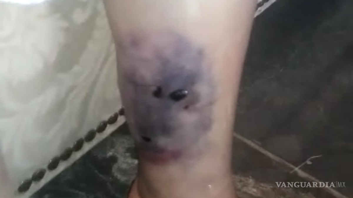 Denuncian por maltrato y lesiones a asilo de adultos mayores de Saltillo