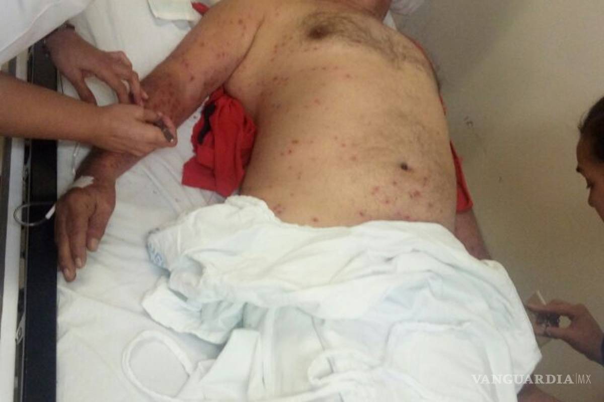 $!Enjambre ataca a familia cuando sepultaban a familiar en Parras