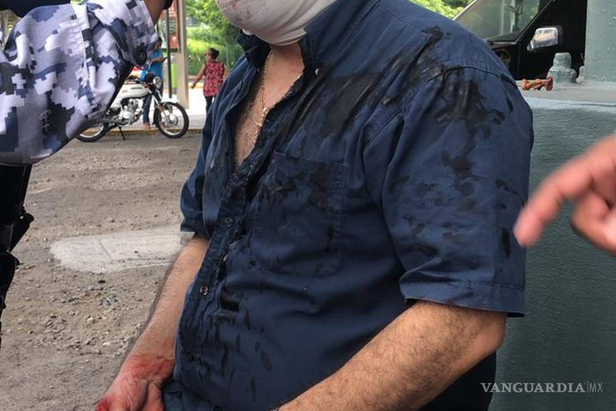 Apuñalan a hombre en el ojo tras discusión por cajón de estacionamiento en Veracruz
