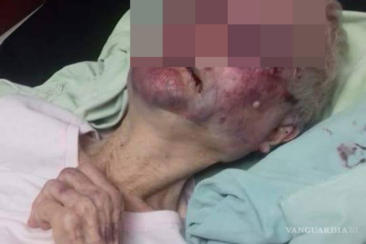 Estable, anciana ‘golpeada’ en Frontera, Coahuila