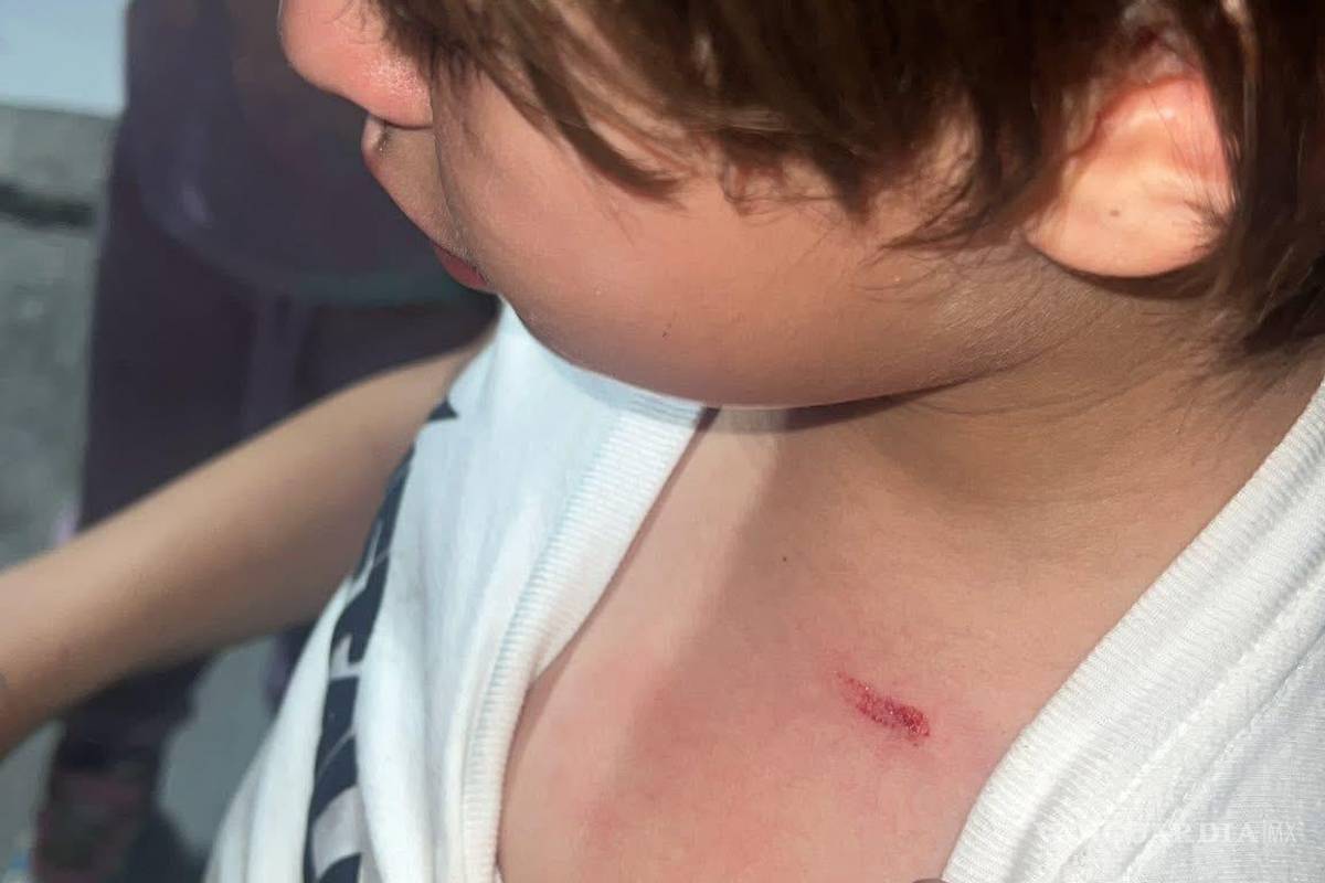 Investiga FGE a hijo de escolta por herir con pistola de postas a menor en Saltillo