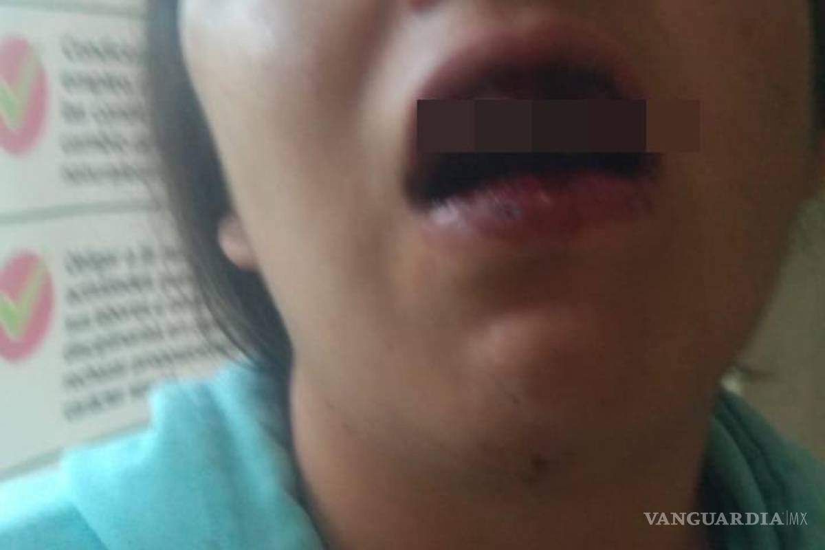 Saltillo: enfurece porque su pareja lo manda a trabajar y le tumba los dientes