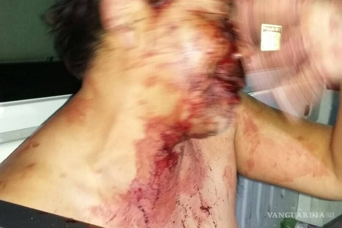 Se mete a una casa y se desnuda; vecinos lo tunden a golpes en Saltillo