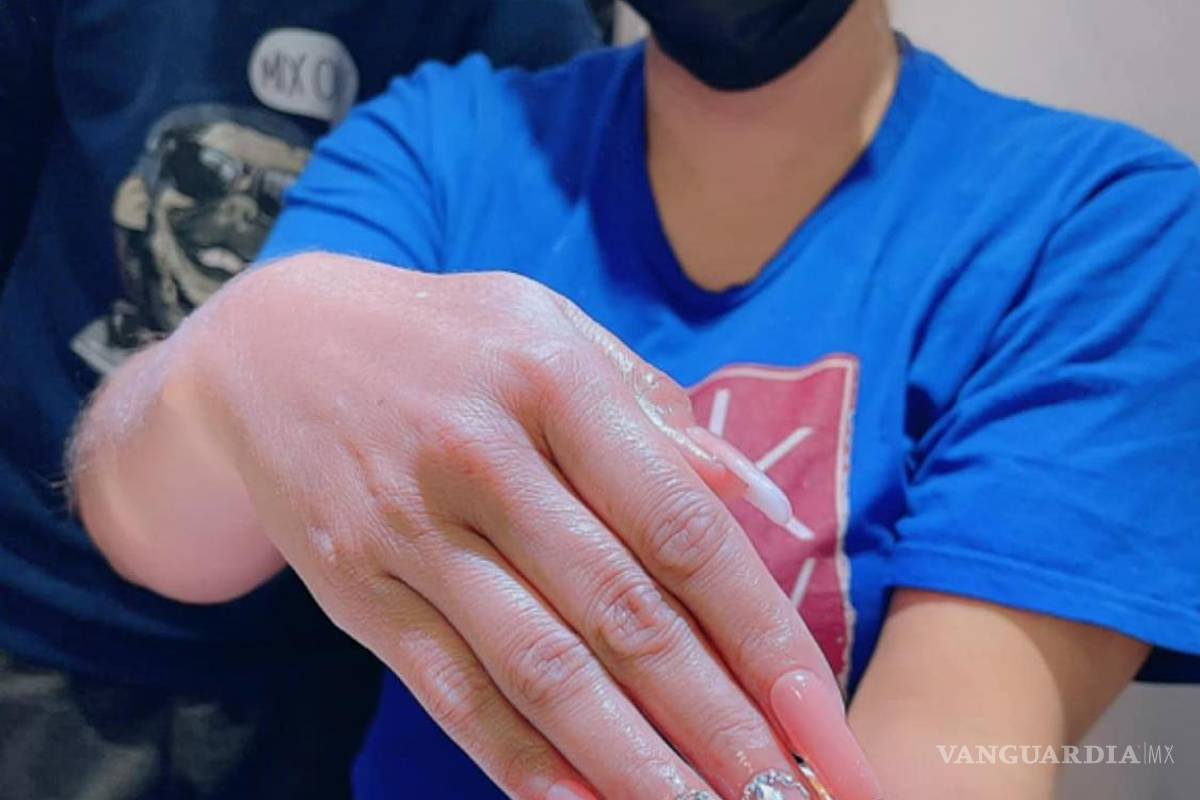 $!Viral: Niño aplica uñas de acrílico para ayudar en operación de su hermanito