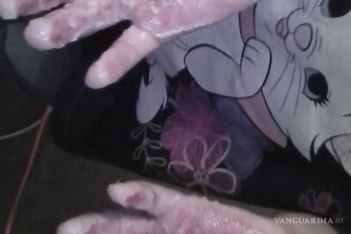 Detienen a mujer por torturar a hijita en Saltillo; le quema las manos en el comal