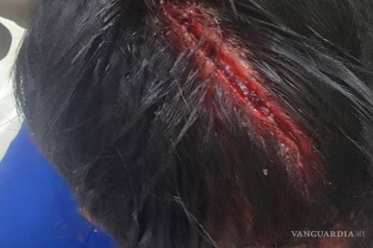 $!La familia de José Omar denunció el brutal ataque que sufrió a manos de un policía municipal, quien utilizó un bate para agredirlo.