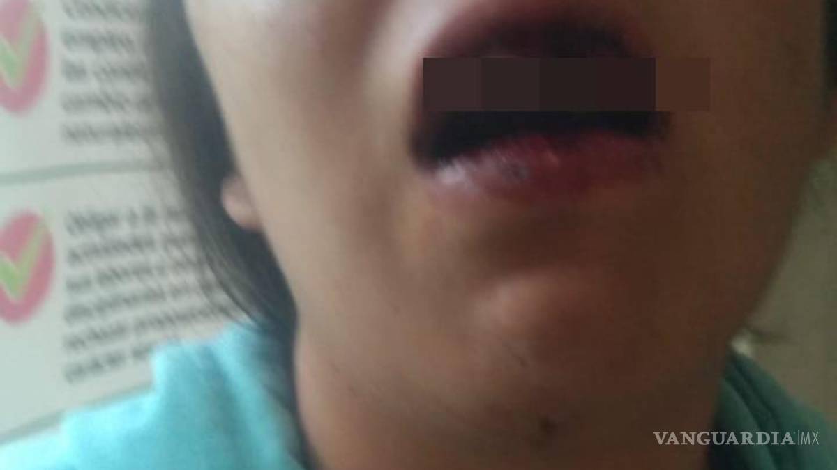 Saltillo: enfurece porque su pareja lo manda a trabajar y le tumba los dientes