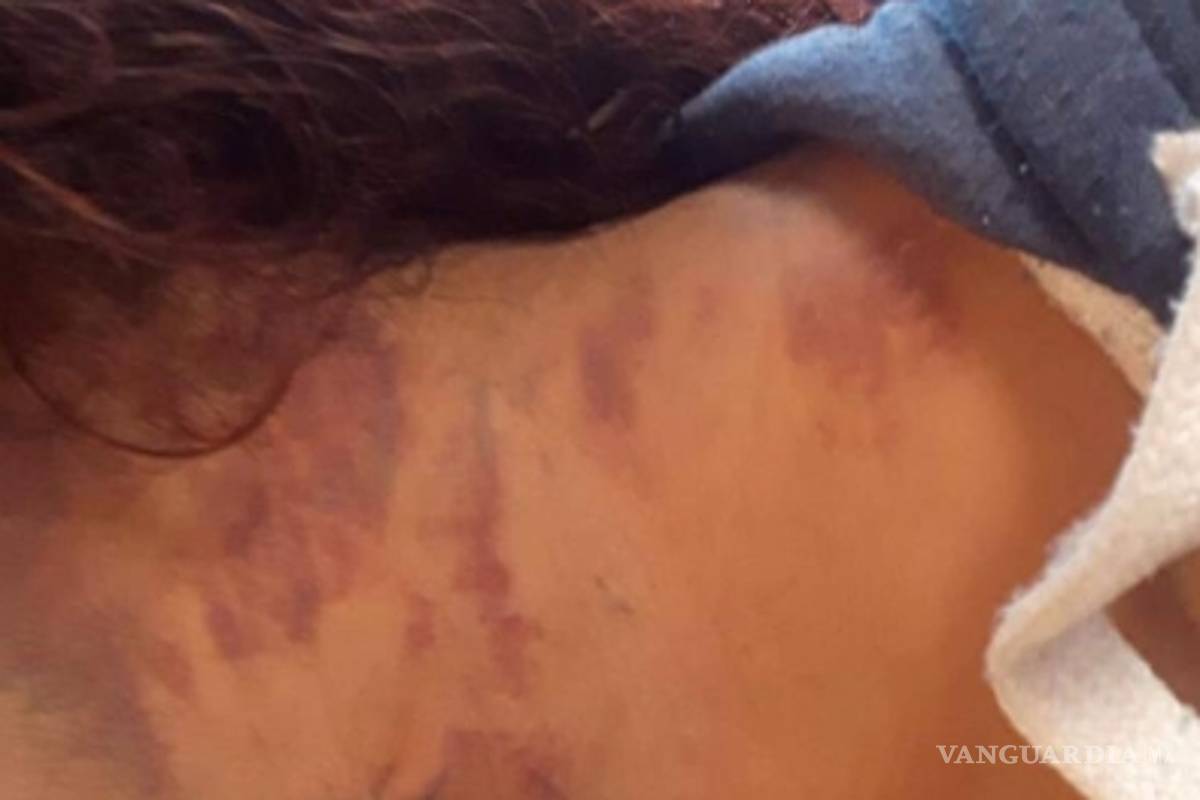 Apuñala a transexual en calles de Saltillo y escapa