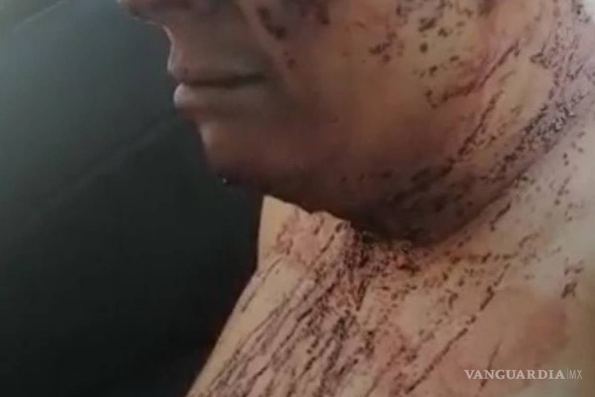 $!Fotos de Ingrid, desollada y asesinada por su pareja, fueron filtradas; estalla indignación