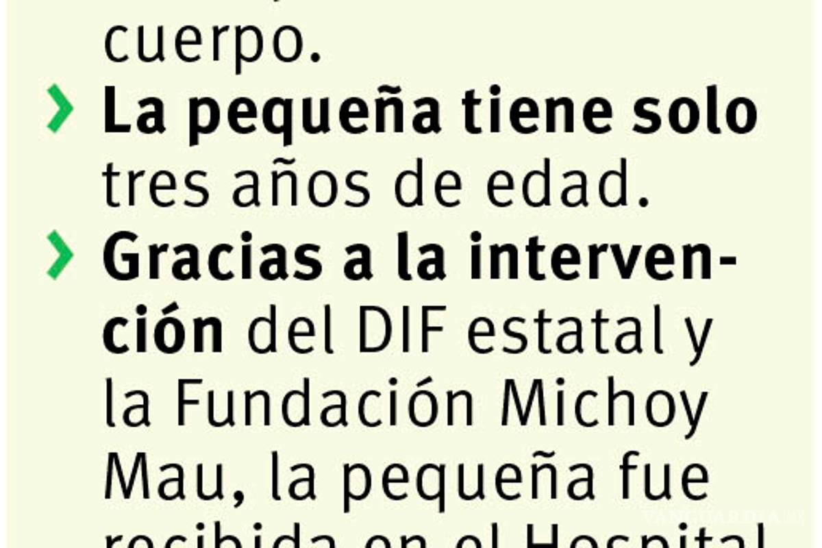 $!Agradece madre atención dada a su hija de tres años que sufrió quemaduras en el 80 por ciento de su cuerpo en Torreón