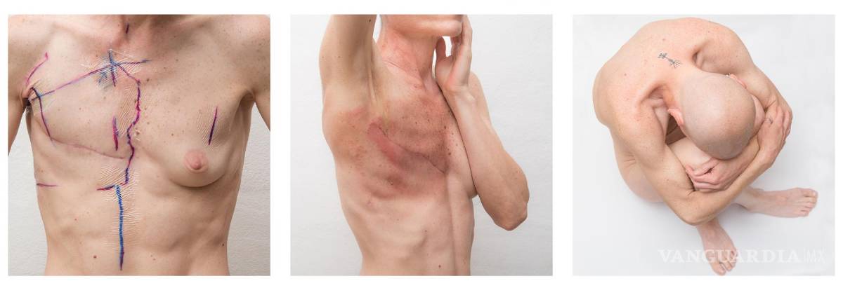 $!Obra de Ana Grúdine sobre el cáncer de mama.