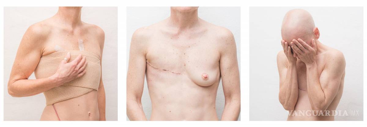 $!Obra de Ana Grúdine sobre el cáncer de mama.