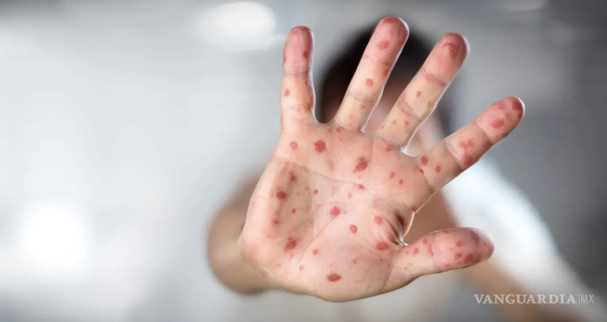 $!La mayoría de los estados reporta cifras controladas, siete entidades concentran los llamados “focos rojos”.