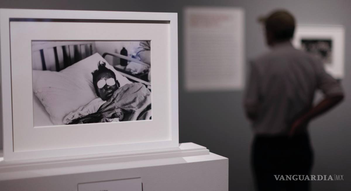 $!Imagen del fotógrafo de la revista Life, Frank Dandridge, de Sarah Jean Collins en el hospital tras quedar ciega por una explosión en la iglesia de Birmingham.