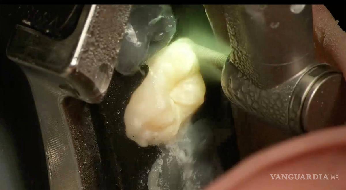 $!Primer plano de intervención robótica en un maniquí.