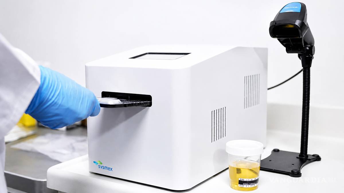 $!El sistema Sysmex PA-100 AST, capaz de detectar bacteriuria, es decir la presencia de bacterias en la orina, y efectuar pruebas de sensibilidad antimicrobiana (AST) en tan solo 45 minutos.