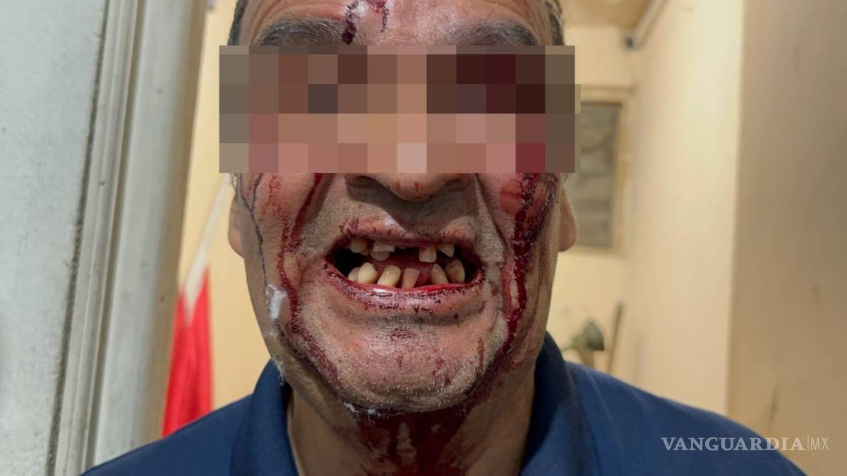 $!El abogado llegó al fraccionamiento bajo los efectos del alcohol , golpeando a don Pedro tras una discusión.