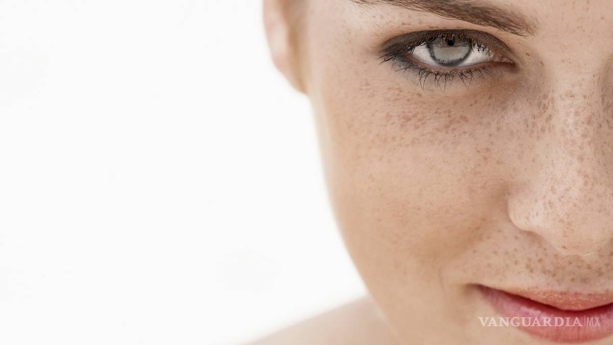 Mujeres con pecas son más atractivas para los hombres