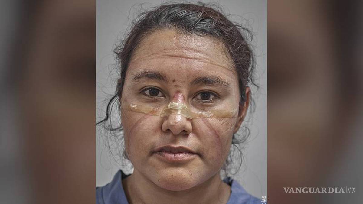 Conquista fotógrafo mexicano el World Press Photo 2021 con foto de “huellas” de COVID en personal médico