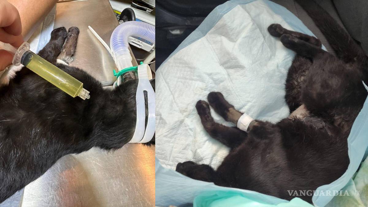 $!De acuerdo a la chica, aunque ha recibido todo el apoyo posible, los tratamientos, medicamentos y la cirugía de Becker son muy costosos