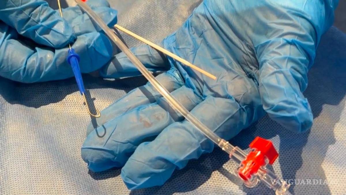 $!Los procedimientos requieren equipo especializado y personal capacitado en terapia endovascular neurológica.