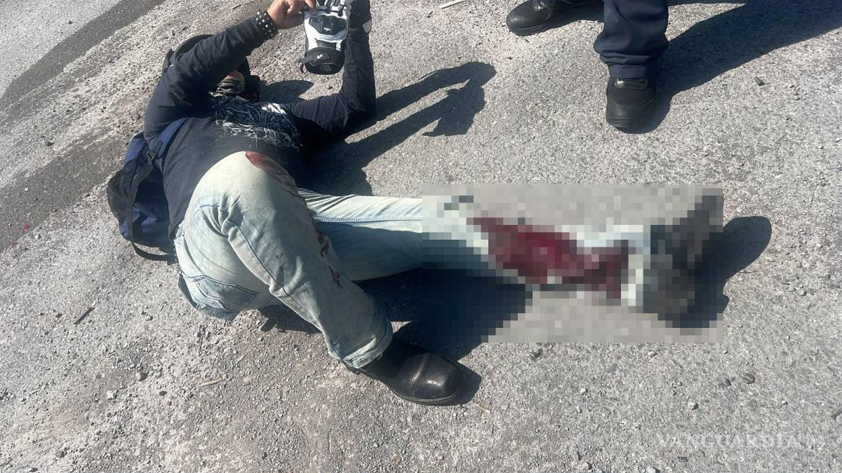 $!El motociclista quedó tendido sobre el pavimento con lesiones de consideración mientras era auxiliado por cuerpos de emergencia.