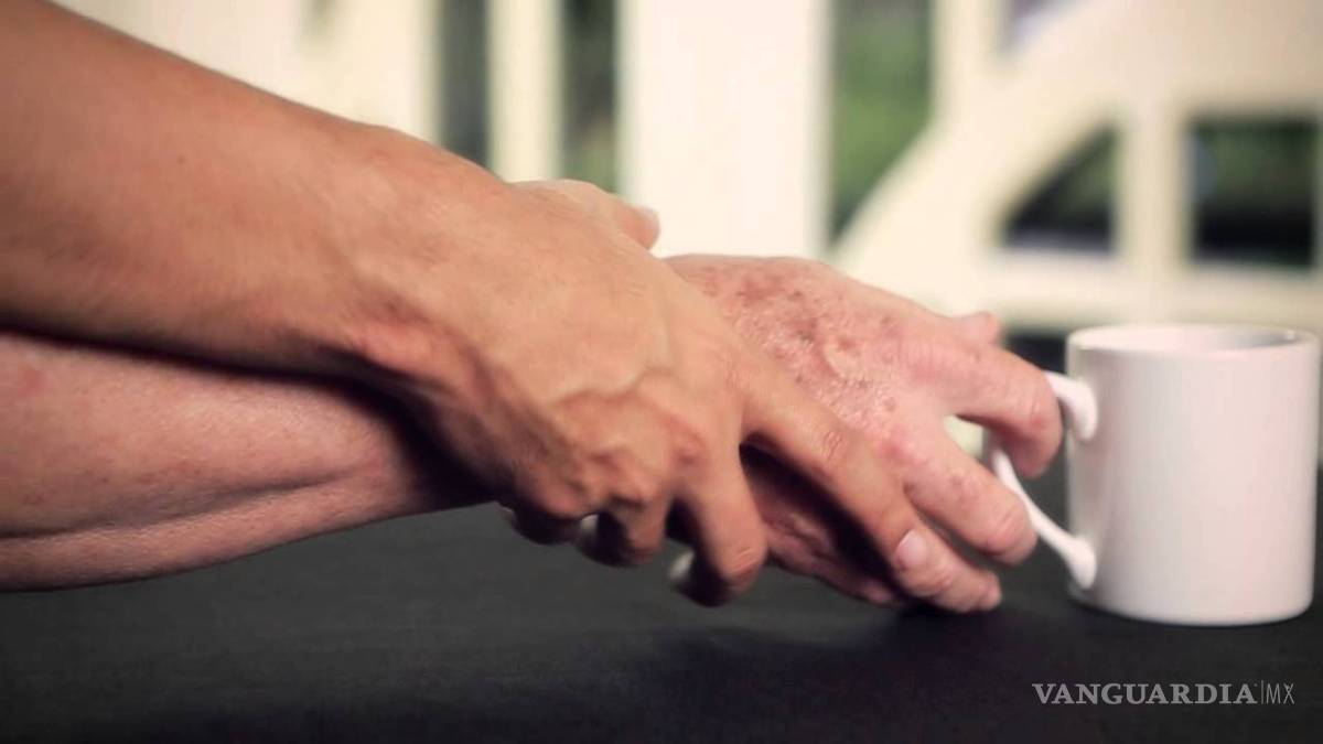 $!Los 10 síntomas tempranos para saber si padeces Parkinson