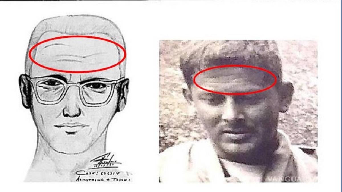 $!Cicatrices del Asesino del Zodiaco que coinciden con las de Gary F. Poste