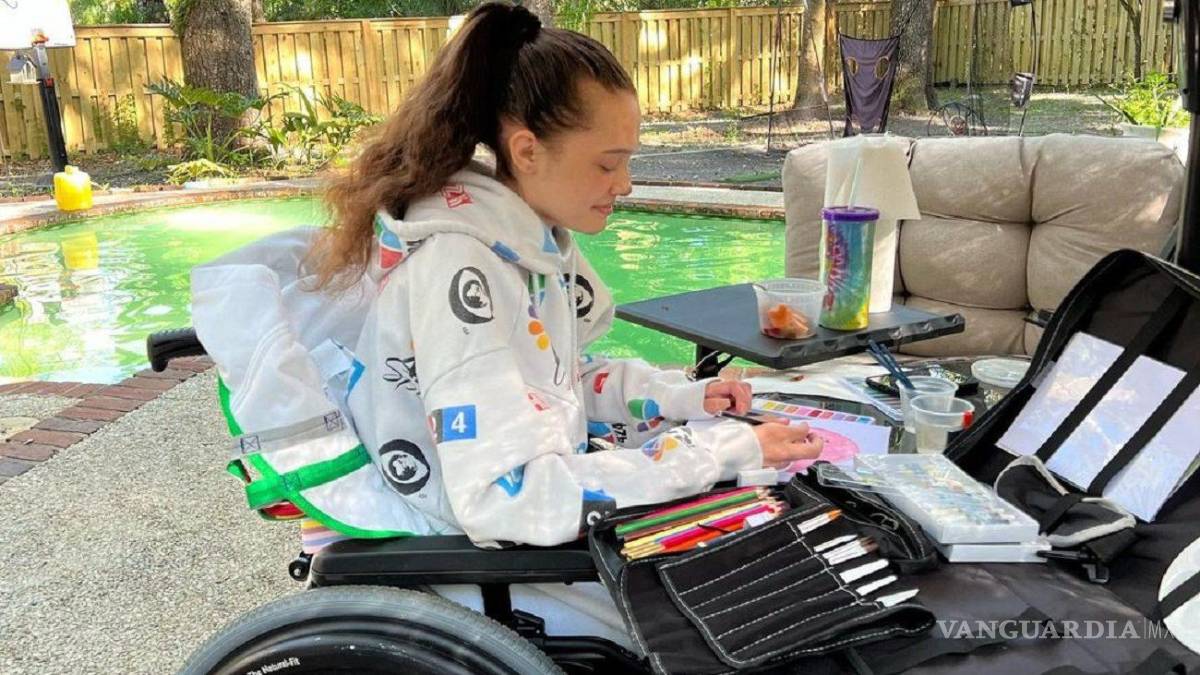 $!Modelo perdió ambas piernas por complicaciones de COVID-19, ‘estaré caminando en poco tiempo’