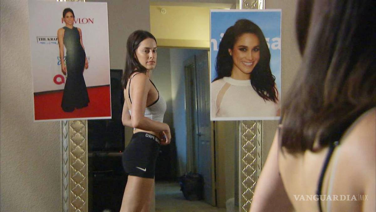 $!Mujer se somete a cirugía de 6 horas para verse igual a Meghan Markle