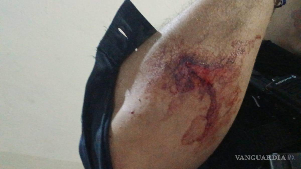 Detienen a tres jóvenes por agresión a unos policías y daños a una patrulla, en NL