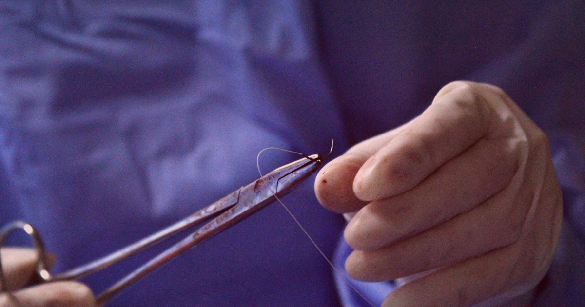 Menor de edad fallece tras cirugía estética en Durango; caso causa debate en redes sociales