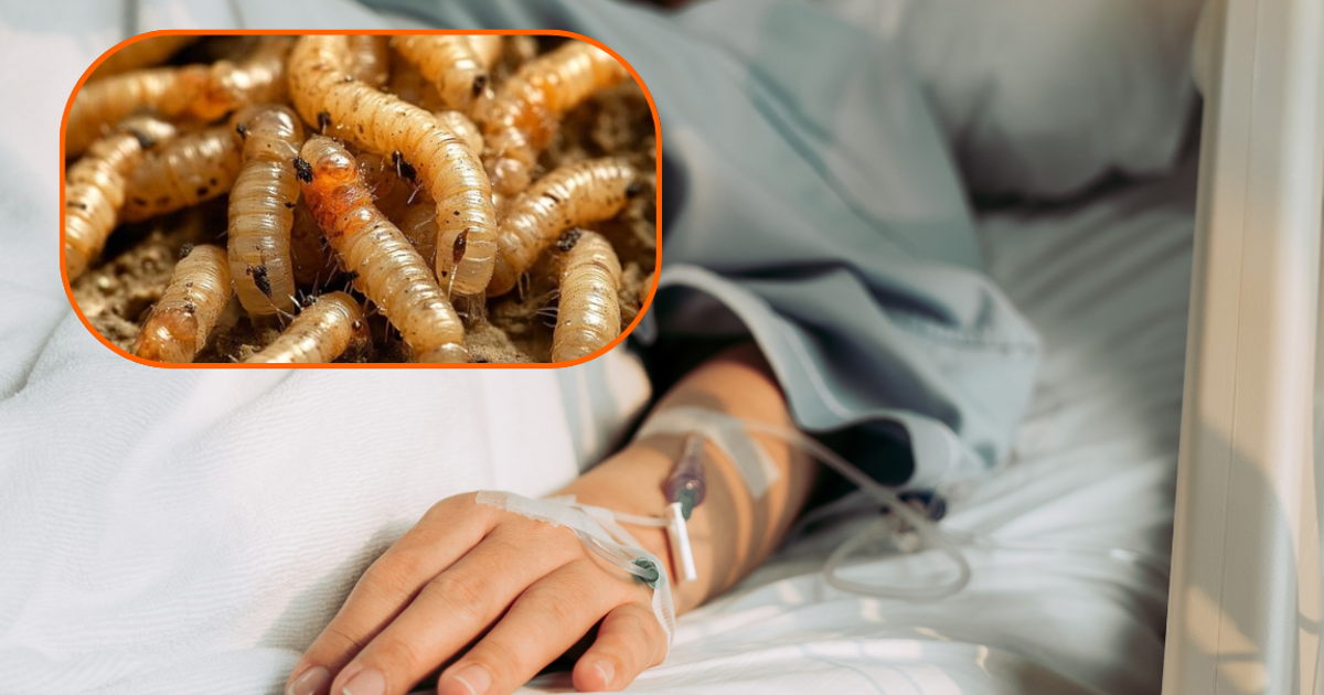 Contagios de gusano barrenador en humanos se extienden a Yucatán y Tabasco