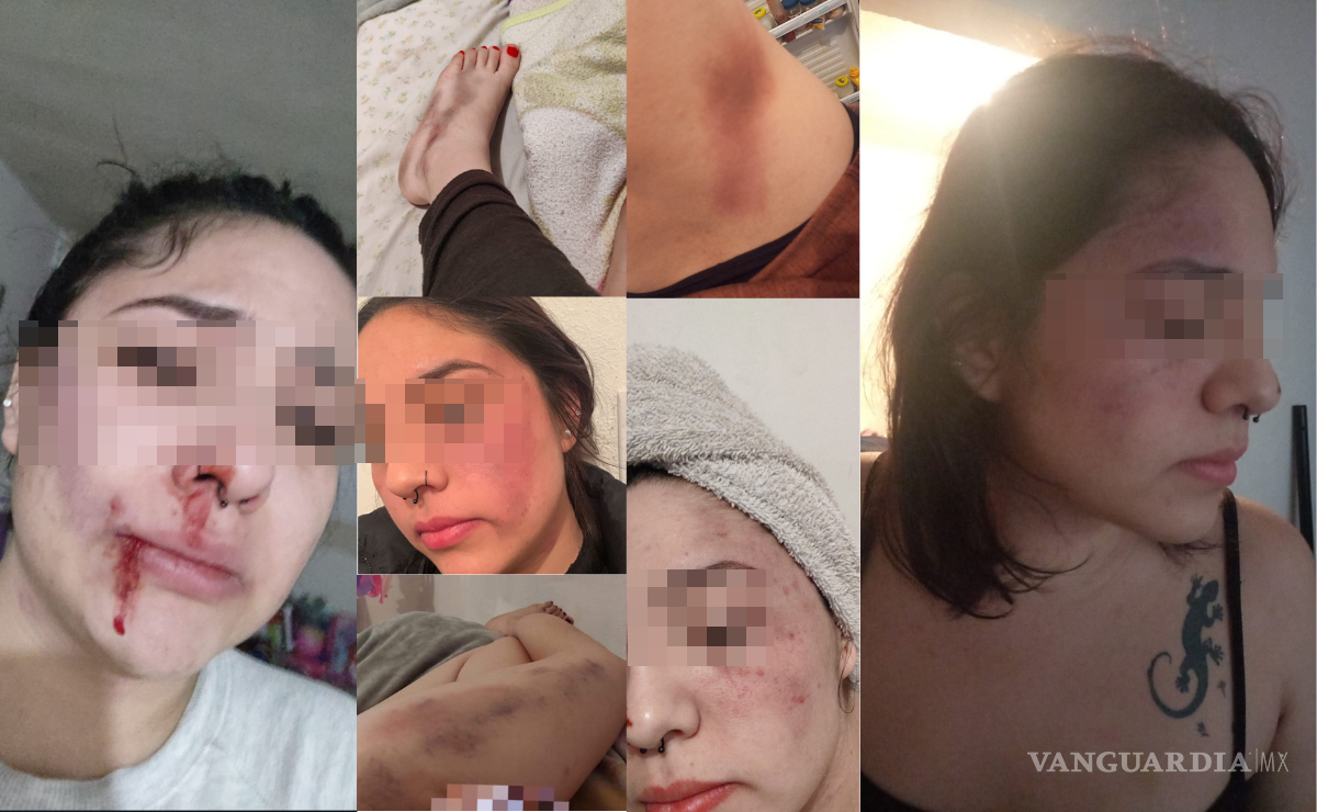 $!La joven ha sufrido diferentes atentados físicos en su contra, los cuales le han dejado secuelas en rostro y partes del cuerpo.