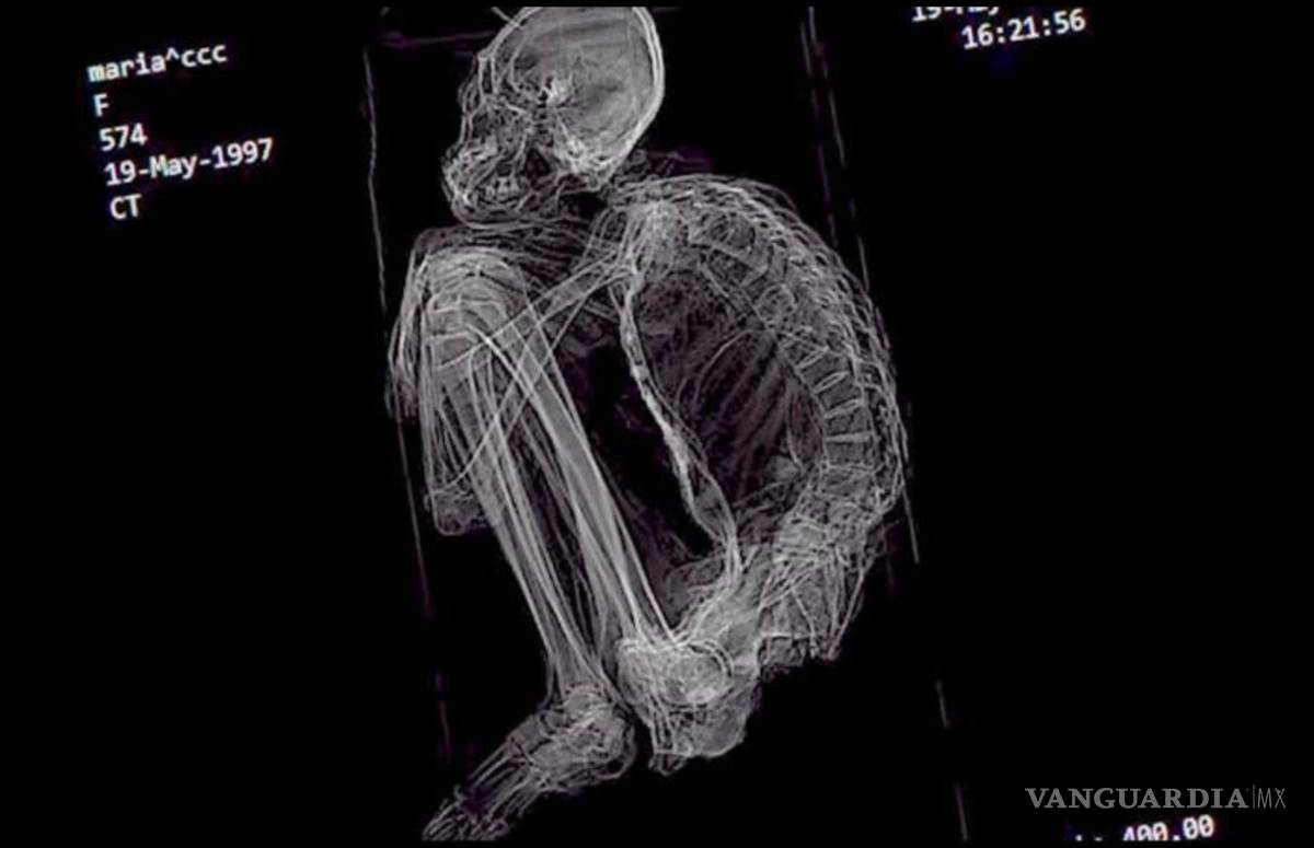 $!Descubren polémica momia "extraterrestre" en Perú