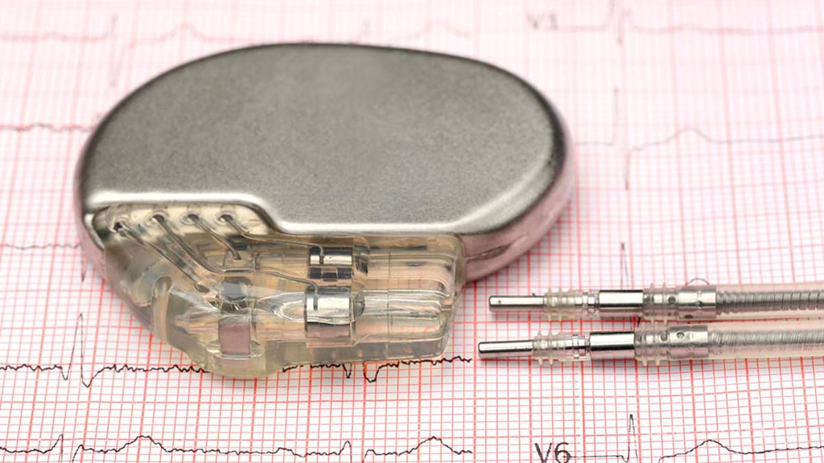 Gobierno de AMLO quiere pagar marcapasos a 90 pesos cuando su precio es de 23 mil