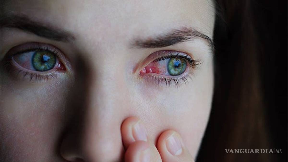 Comezón y dolor de ojos podría ser síntoma temprano de COVID-19