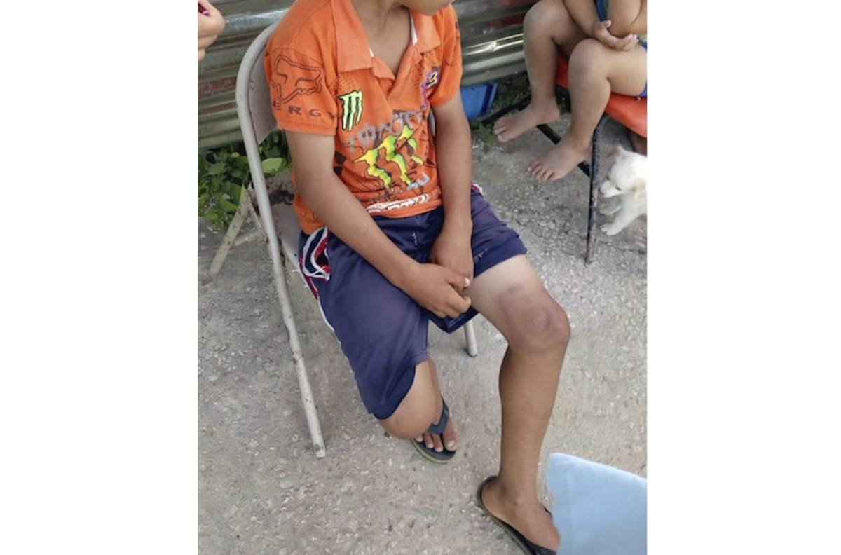 $!Es Pemex; afecta el agua, mata a los manatíes y daña la salud de la gente: pescadores de Tabasco