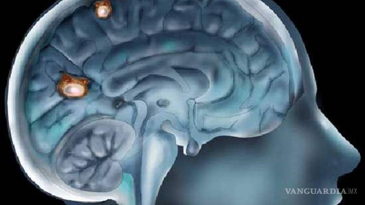 En Veracruz una extraña enfermedad incurable ataca a los habitantes