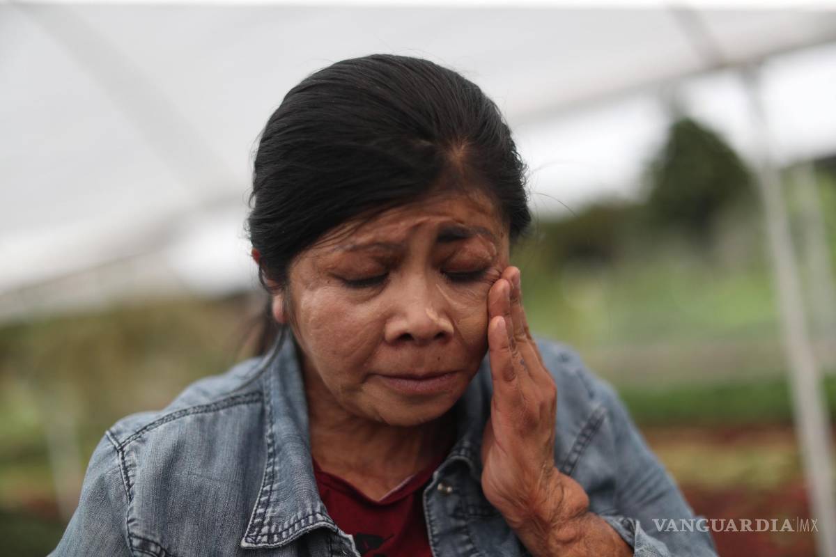 $!Elisa Xolalpa, mujer sobreviviente de ataque con ácido por su entonces pareja Ciudad de México (México).