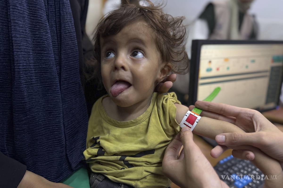 $!El Ministerio de Salud de Gaza dijo el martes que más de 100 personas han muerto mostrando signos de hambre y desnutrición, en su mayoría niños.