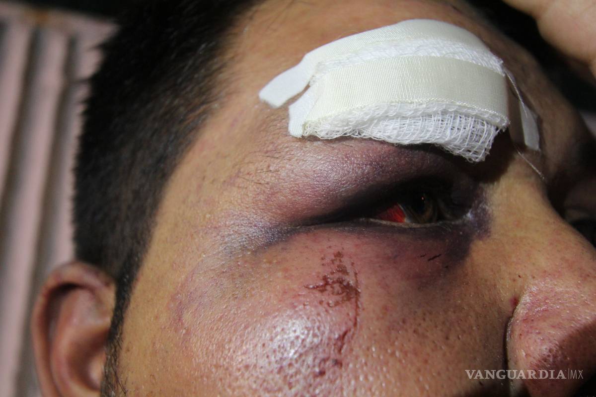 Vinculan a proceso a policías por tortura y abuso de autoridad en Saltillo