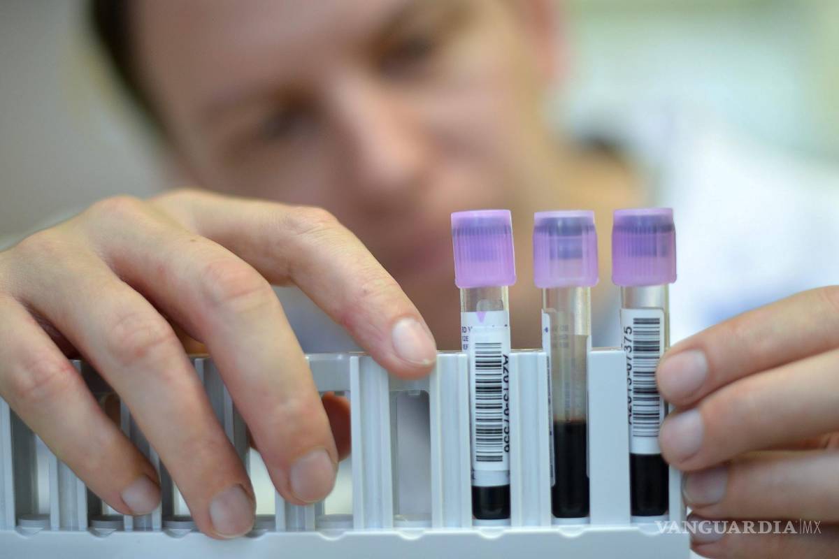 $!Un análisis de sangre y el uso de inteligencia artificial es posible el inicio de la enfermedad de Parkinson hasta siente años de que aparezcan los síntomas.