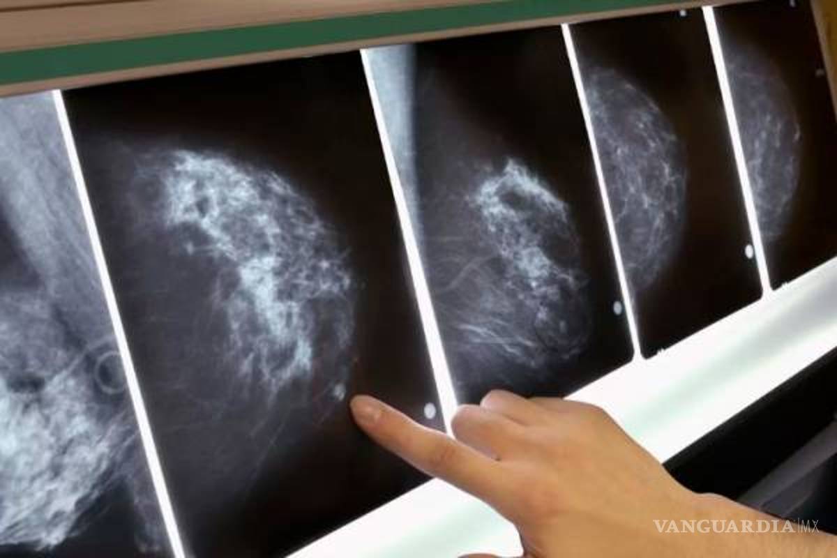 Google crea inteligencia artificial que detecta cáncer de mama mejor que los médicos